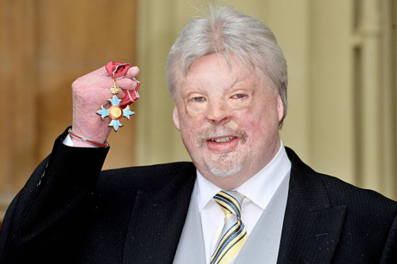simon weston injuries